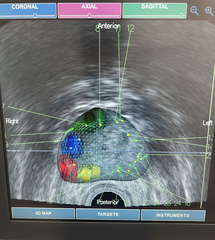 3D prostate image