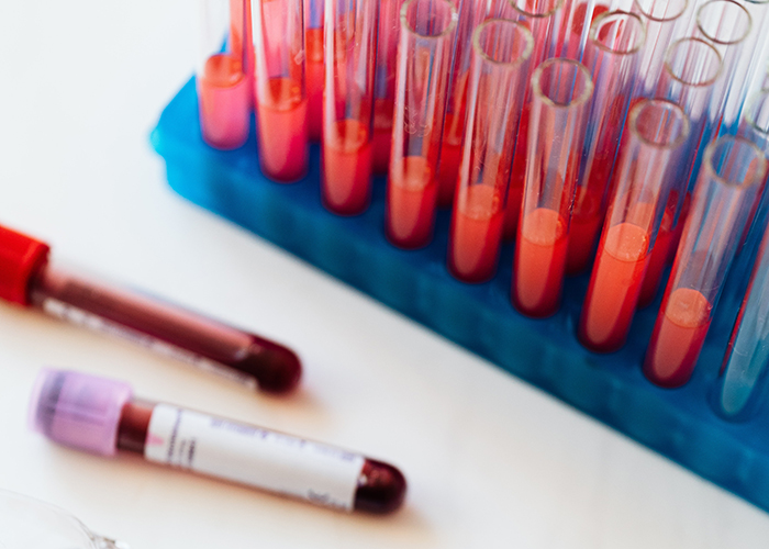 Blood in test tubes