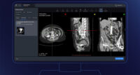 Viz Aortic from Viz.ai is artificial intelligence-powered software designed to detect abdominal aortic aneurysms.