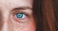 Eye