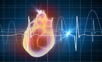 Cardiac care